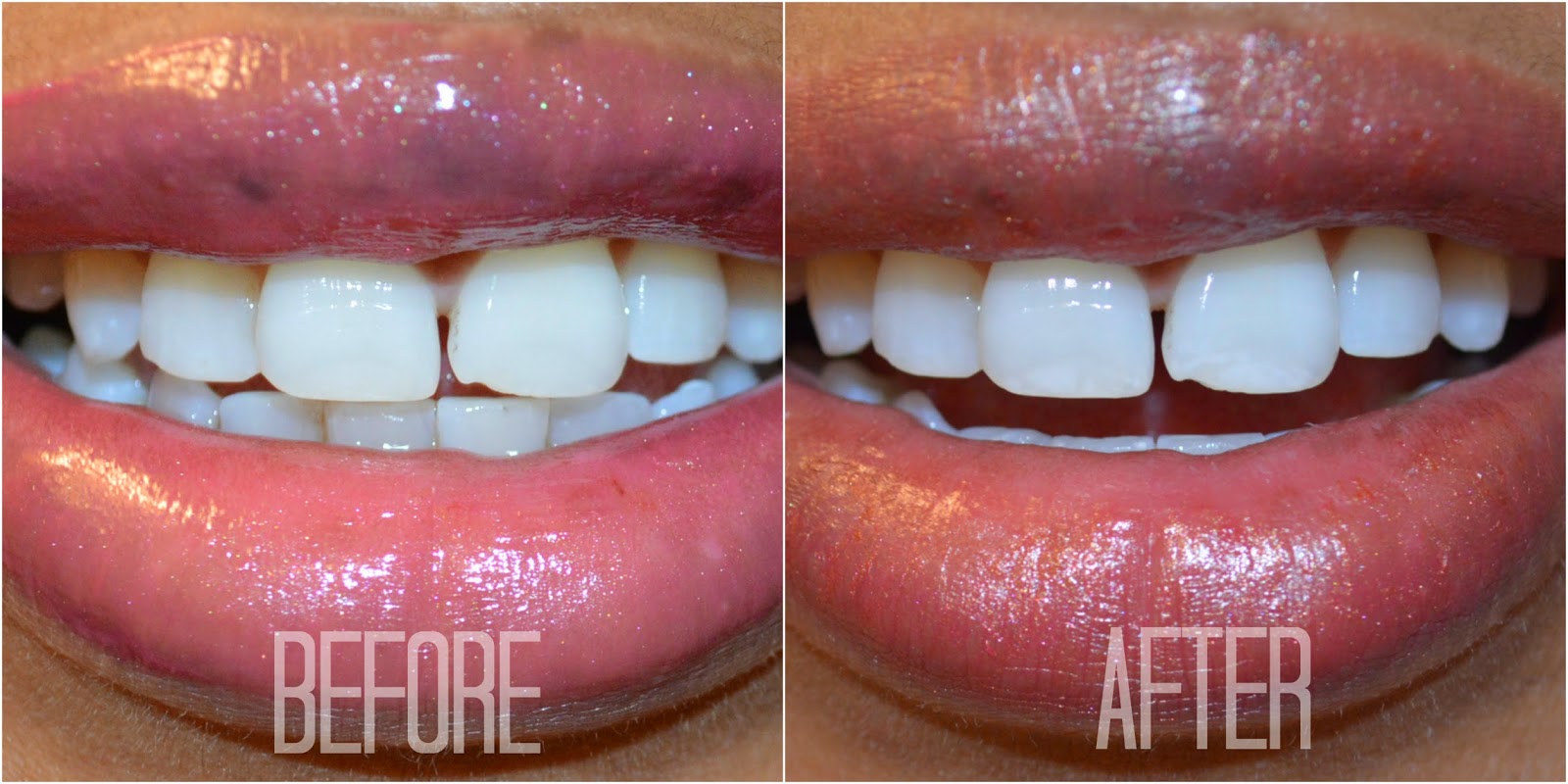 how long does it take to whiten your teeth with crest white strips