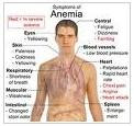 Pengobatan Anemia