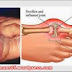 Obat Alami Alternatif Penyakit Nyeri Sendi thumbnail