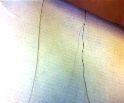 Random / weird/ coarse/ strange thick hair strands: Information found on  various forums and internet sites