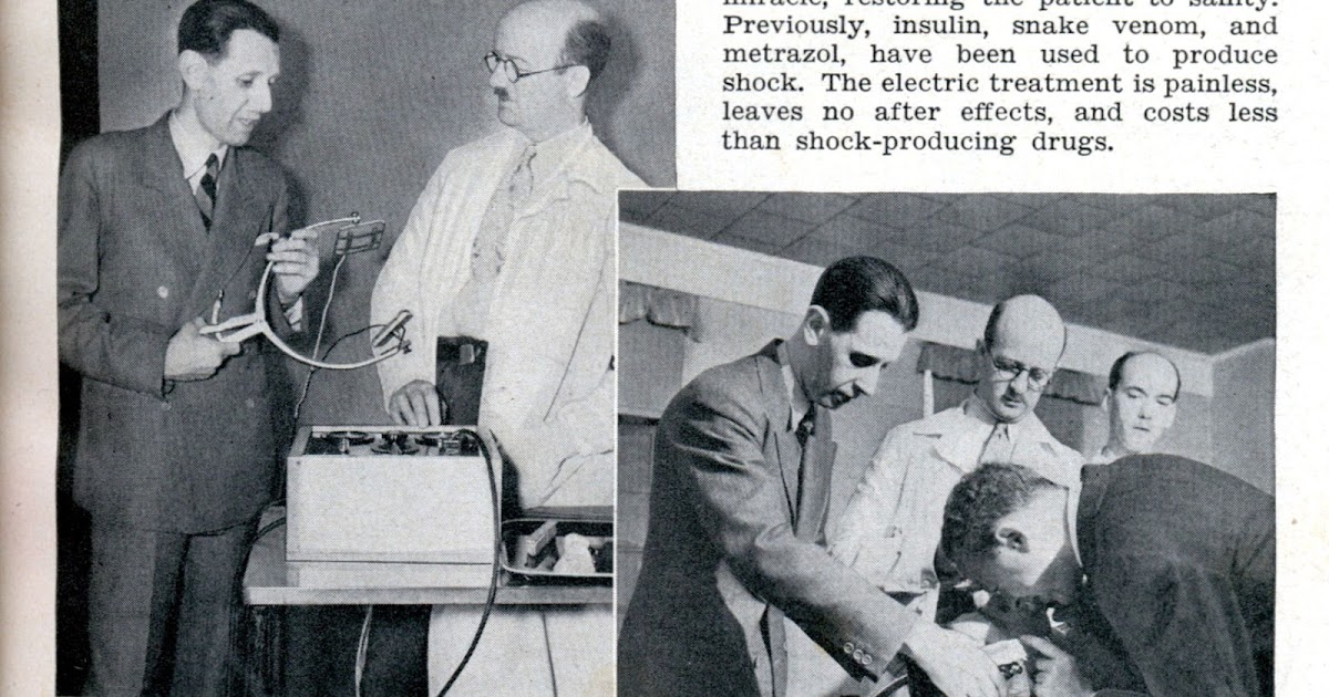 Bipolar ECT Electroconvulsive history