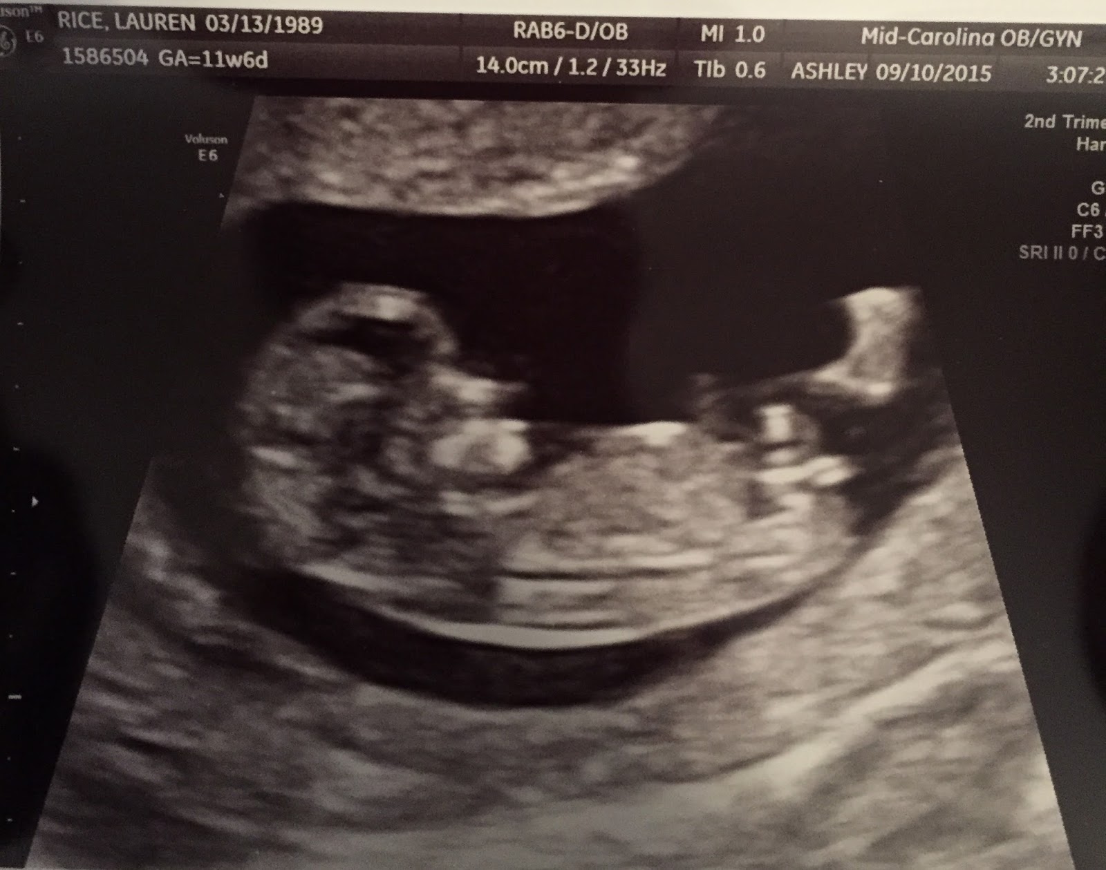 red white and becoming mama rice 12 weeks 12 week fetus size