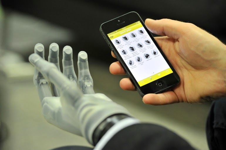 Touch Bionics prosthetic hand