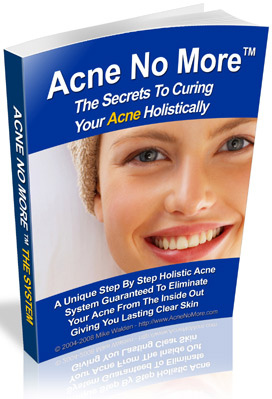 ACNE NO MORE