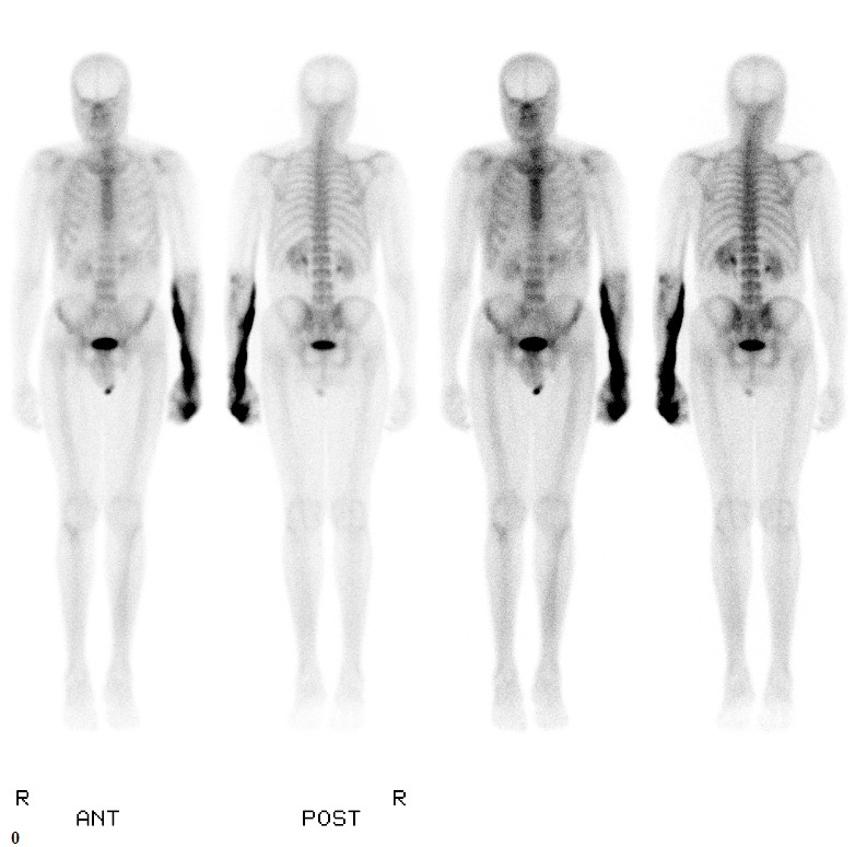 NuCleaR MuNkeE March 2012