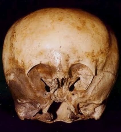 The Biggest Secrets Of The World: 900 Years Old 'Starchild' Skull