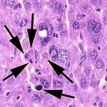 Apoptosis Imagenes reales