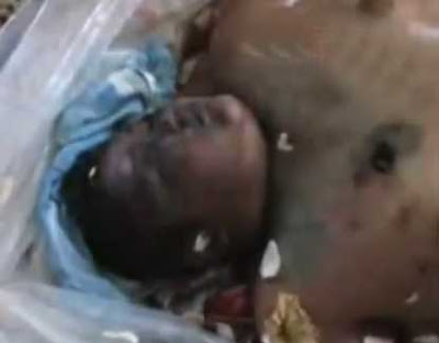 بالفيديو تعذيب طفل سوري وقطع عضوه التناسلي