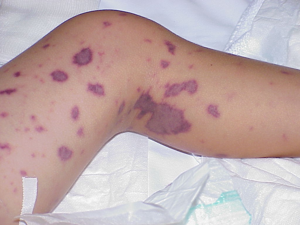La crema que blanquea polsha