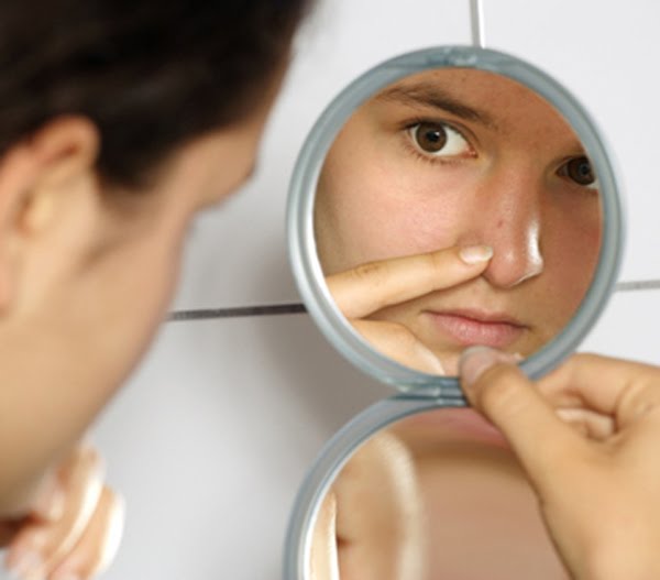 How To Get Rid Of Blackheads Home Remedies. get rid of your lackheads