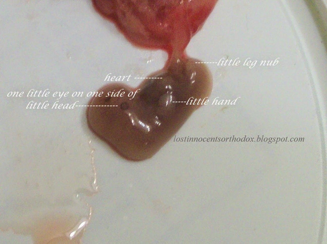 How Fast Can You Get Pregnant After A Natural Miscarriage How Fast Can You Get Pregnant After A Natural Miscarriage