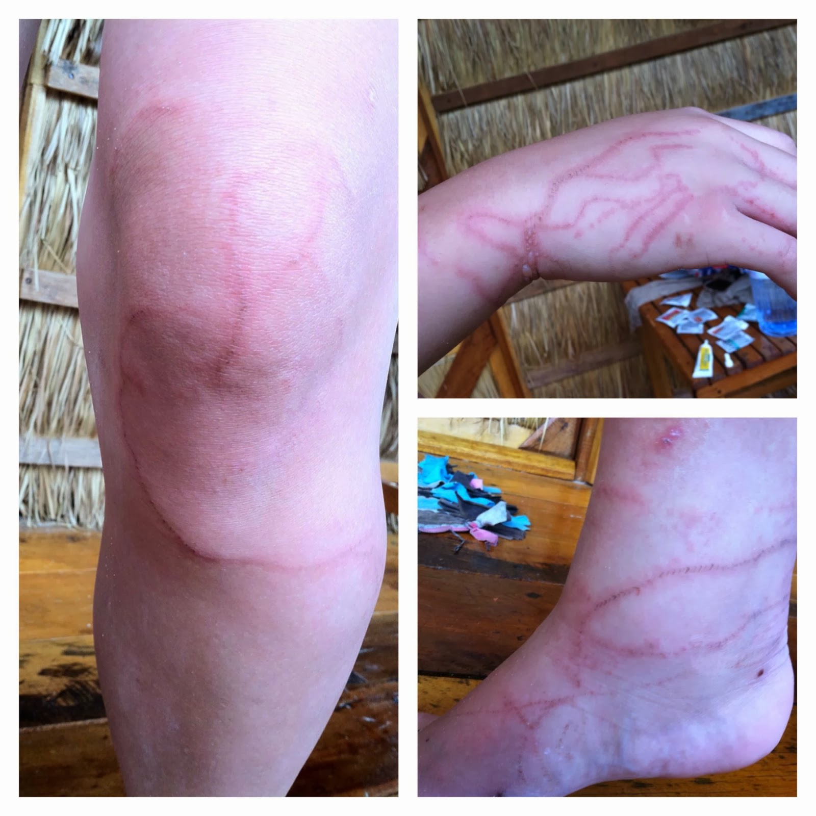 From the Philippines to Cambodia Danger Lurks