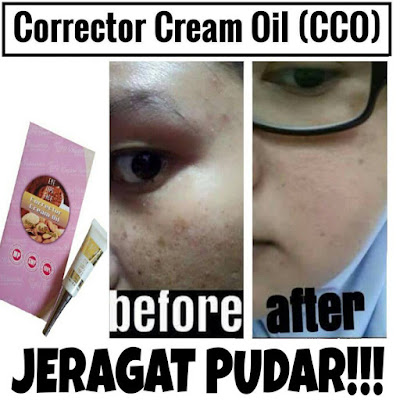 corrector cream oil