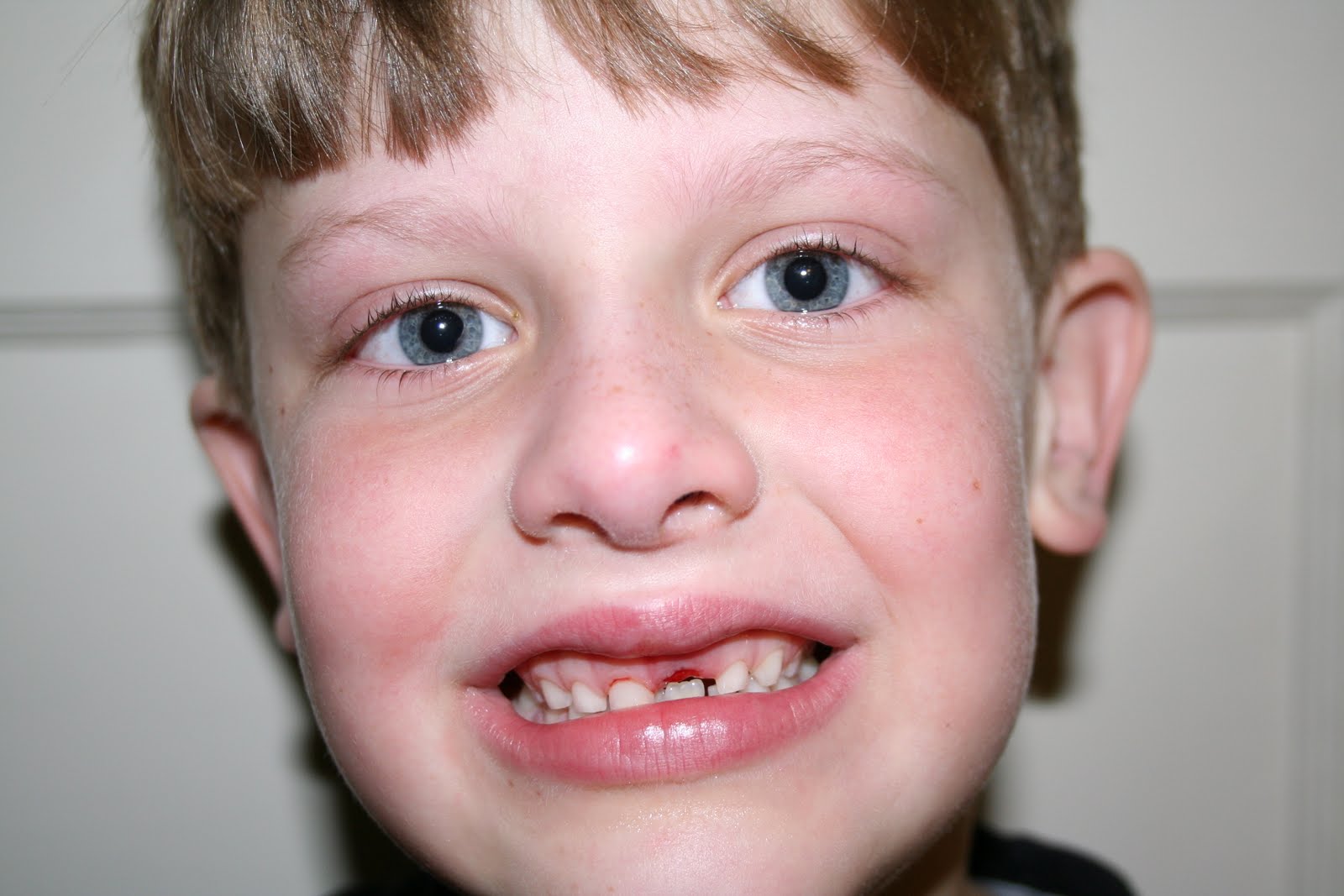 All About Brant & Brylee Snaggle Tooth