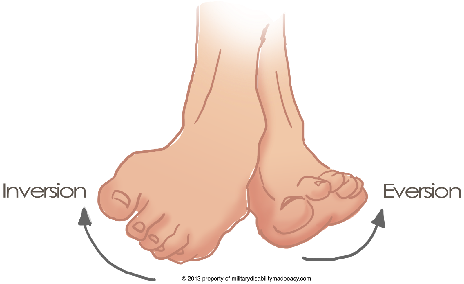 Over-Pronation