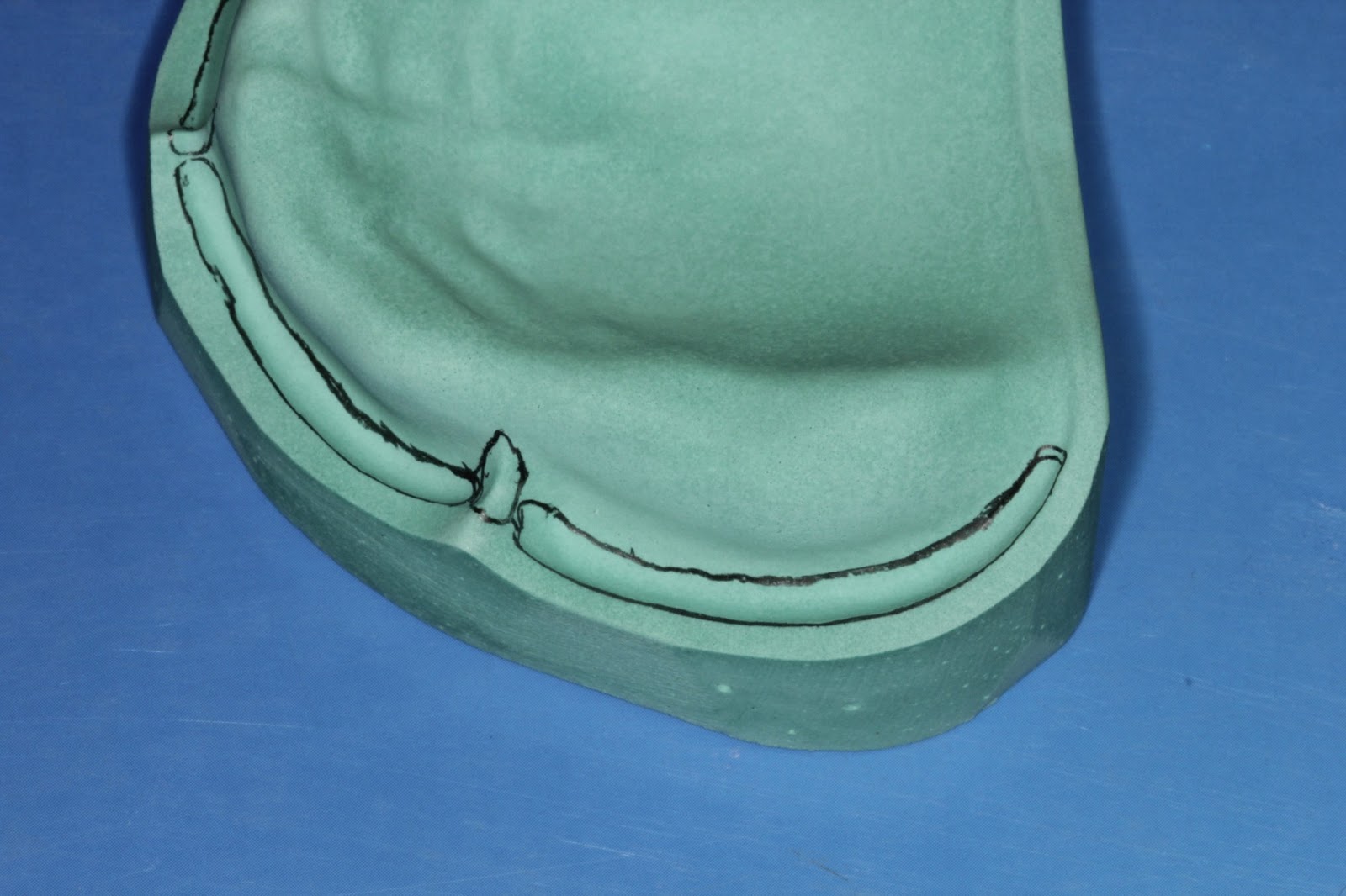 Step by step Guide for Understanding the Prosthodontics Anatomical