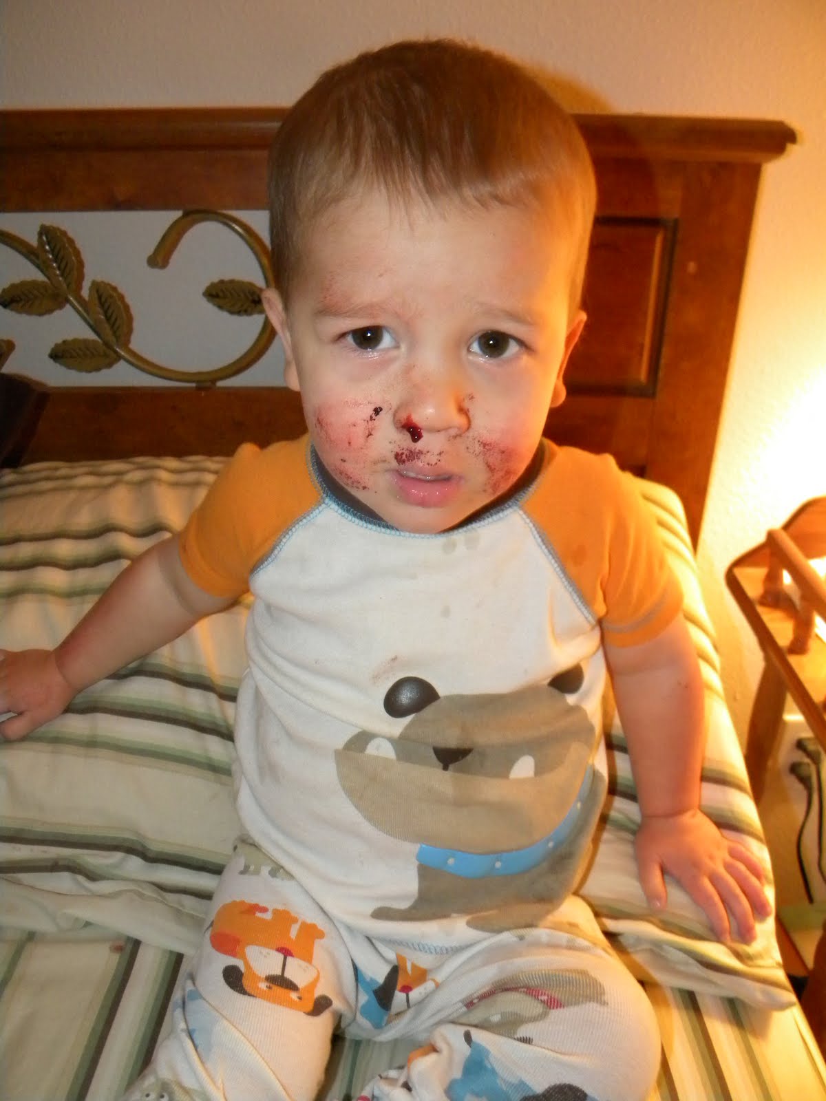 The Heaton's Bloody Nose