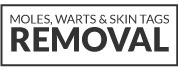 Moles, Warts & Skin Tags Removal