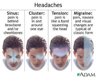 various-types-of-headache