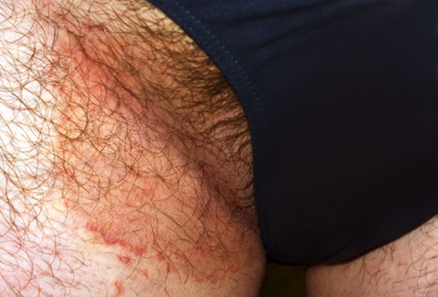 Jock Rash Pictures