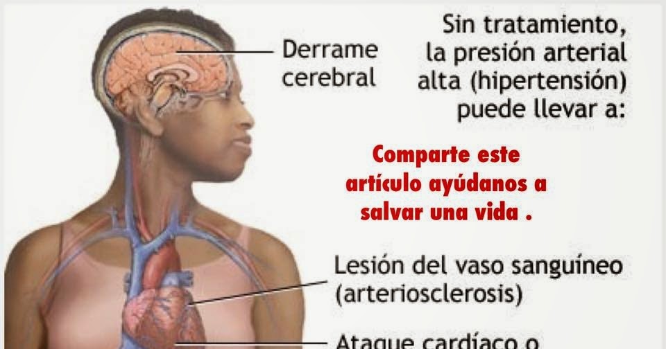 Adelgazamos en kremlevke las revocaciones