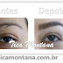 Sobrancelha: antes e depois!