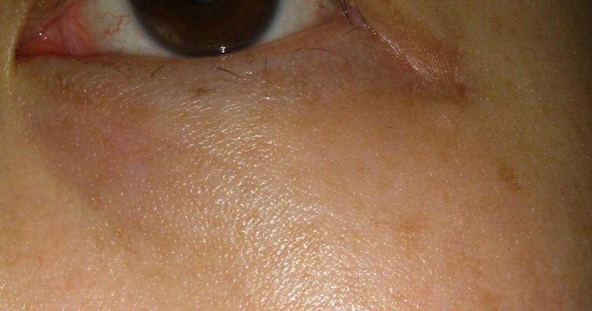 JL Journal What do you use when your face ITCH and is super red??