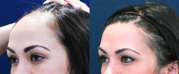 cosmetic surgery & hair transplant