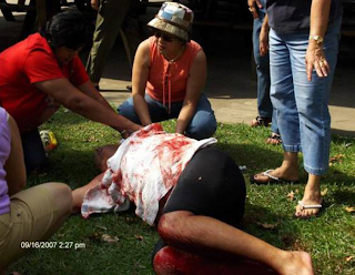 My Second Wish: Alligator Bites Arm Off Snorkeler