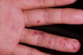 LESIONES DEFINICION lesiones definicion: