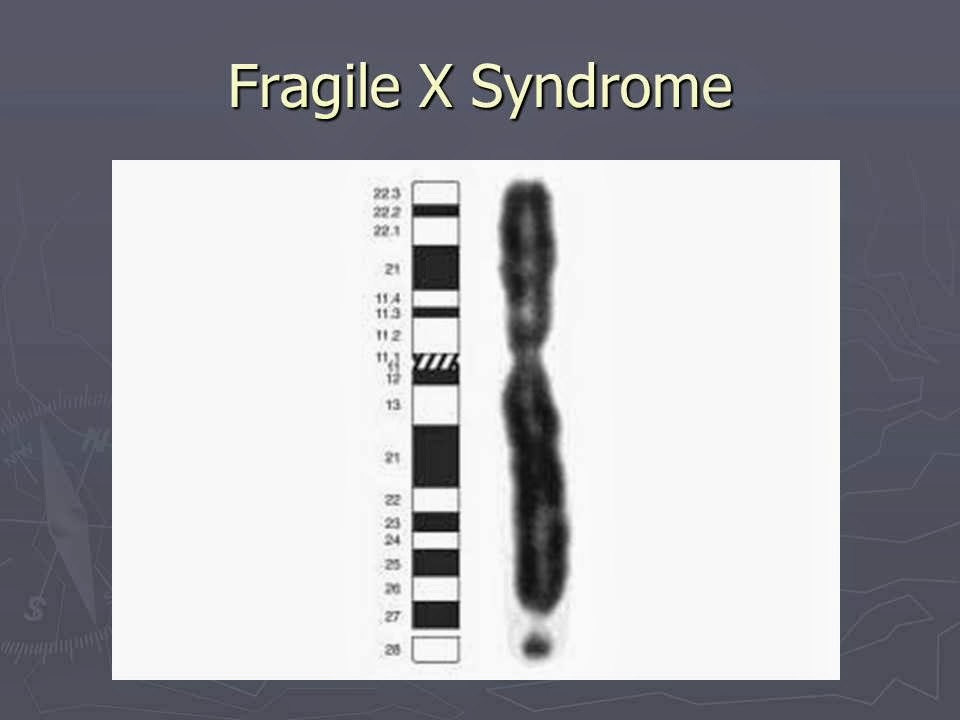 Slide 50