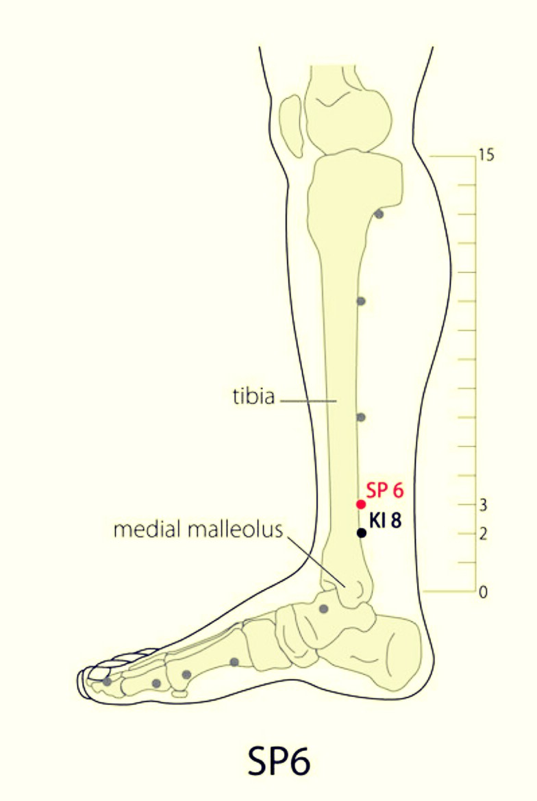 Saro Epic Acupuncture Clinic Acupuncture Points for Polycystic Ovarian