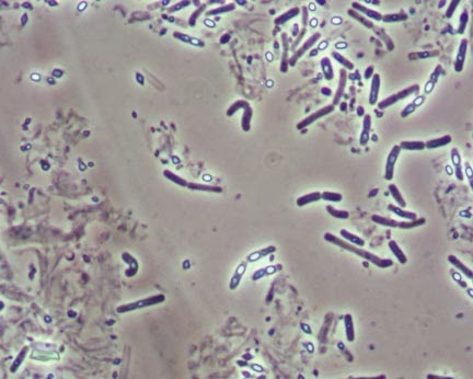 Belajar Biologi Peran Bacillus Thuringiensis Sebagai Pestisida Biologis