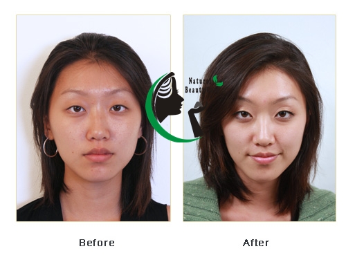 Masker Rambut Kering dan Kusam Masker Rambut Kering dan Kusam