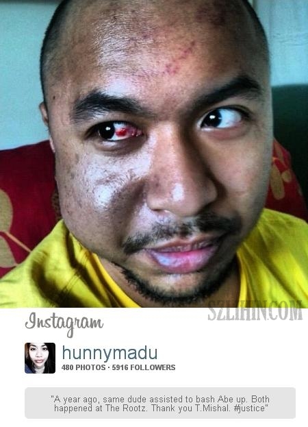 Kena Pukul