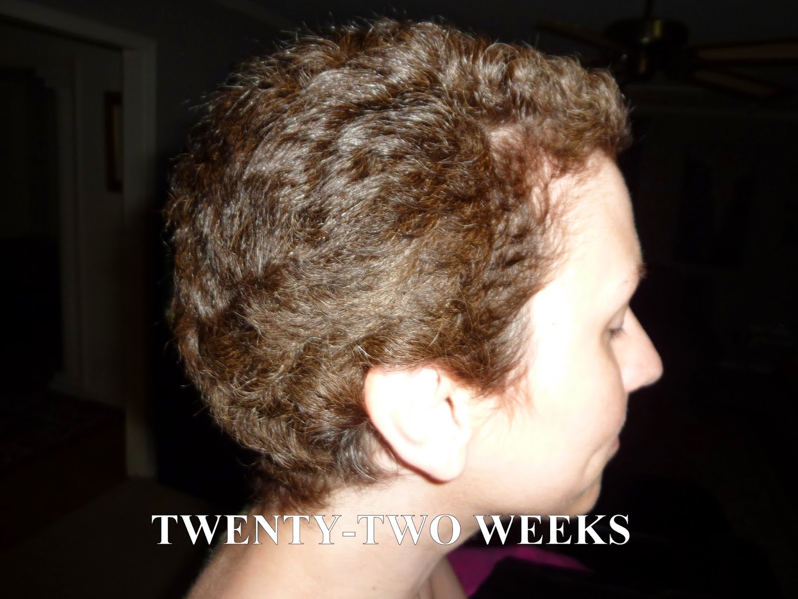 Anncredible: Hair Growth Progression after Chemo- Six Months with UPDATE!