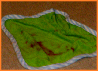green washcloth covered in blood