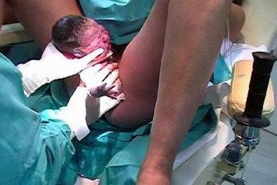 IMAGEN PARTO REAL imagen parto real: