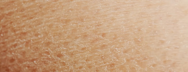 Le psoriasis le nouveau traitement dans la médecine