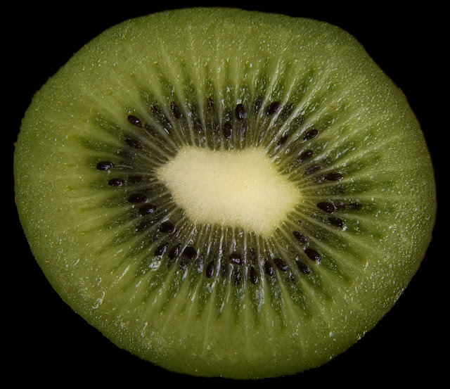 kiwi , fibras