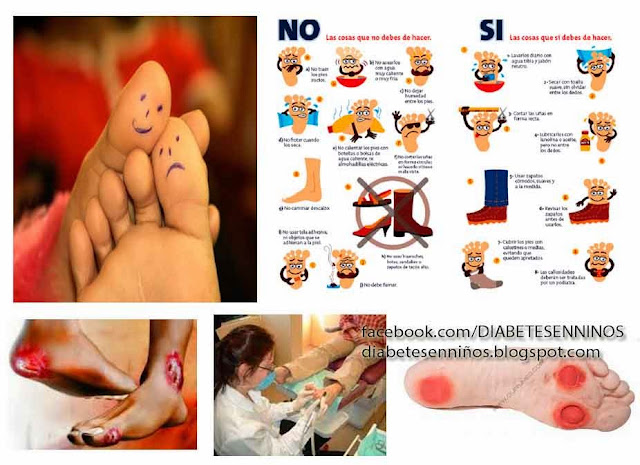 PIE DIABETICOS EN LA DIABETES MELLITUS