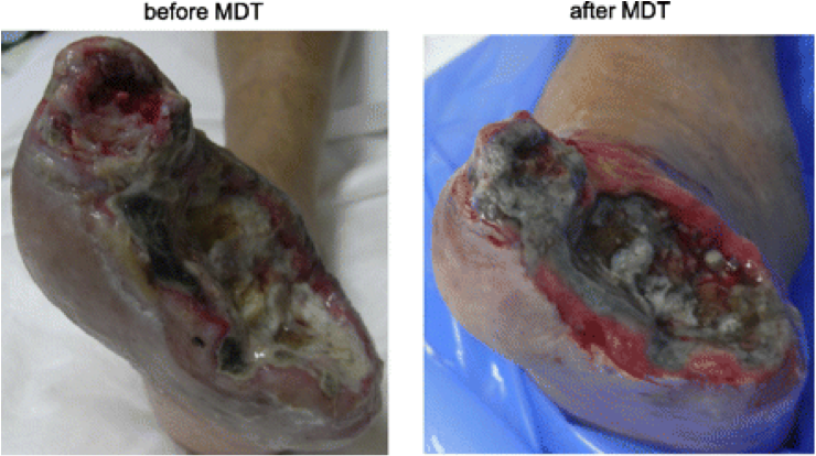 FIGURE 2. Befor...