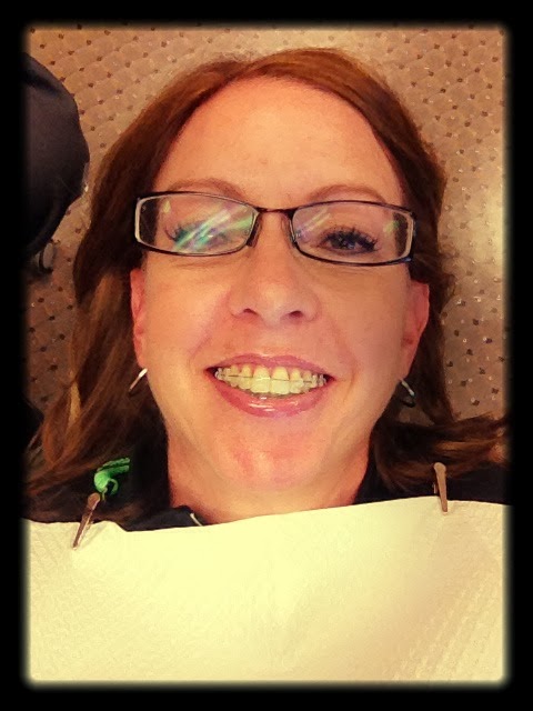 braces fab running lets ready