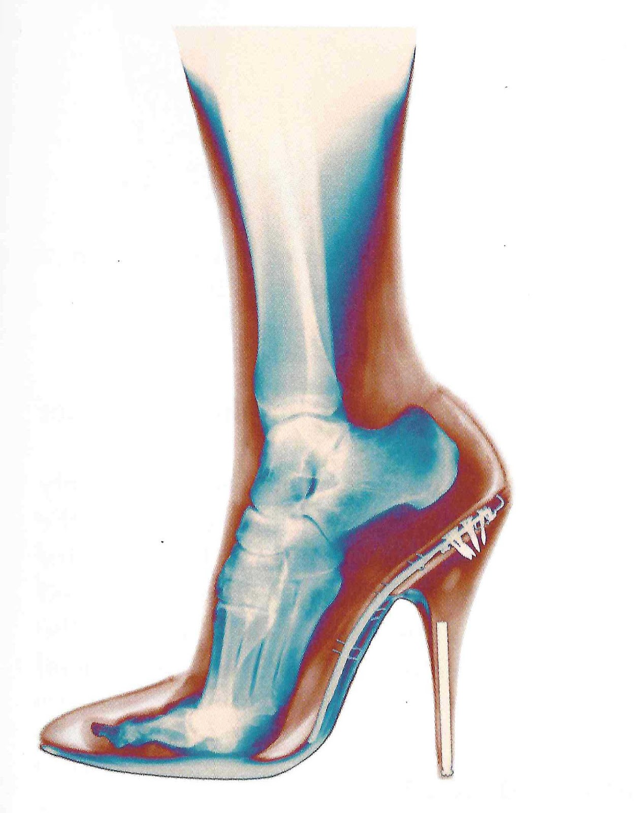 WellnessVancouver Hell on Heels!!