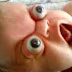 Bayi Yang Matanya Bisa Keluar Saat Menangis Bayi Yang Matanya Bisa Keluar Saat Menangis
