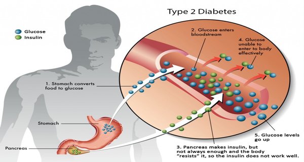 11 Surprising Everyday Things That Spike Your Blood Sugar 11 Surprising Everyday Things That Spike Your Blood Sugar