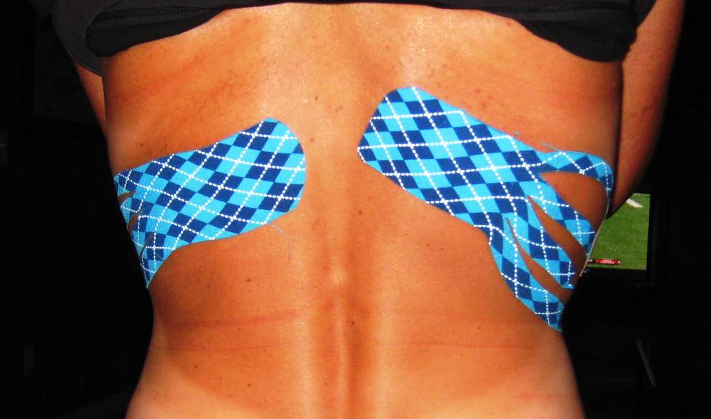 Fast at Forty Kinesio Tape and Fairy Dust