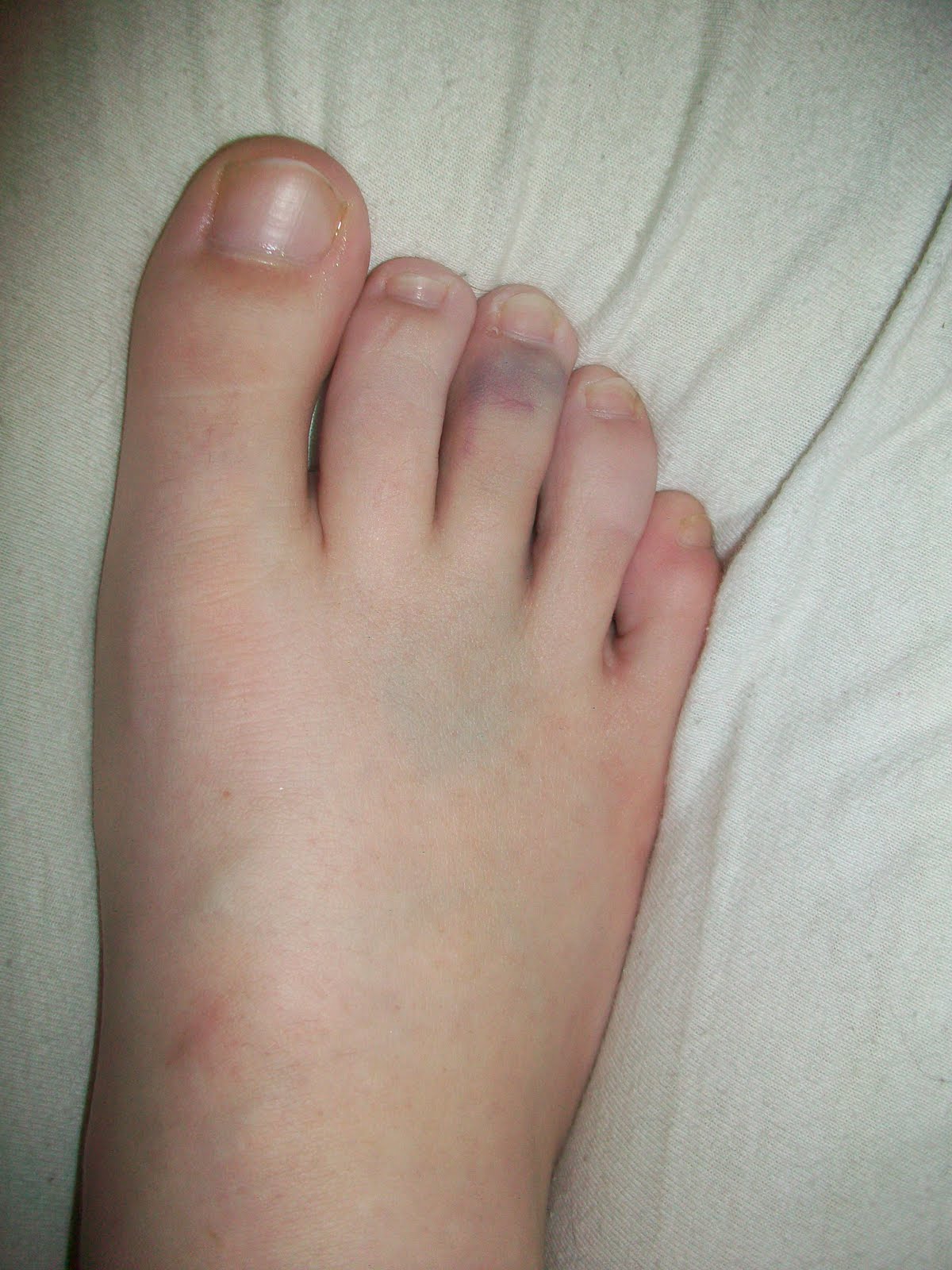 question grey toe