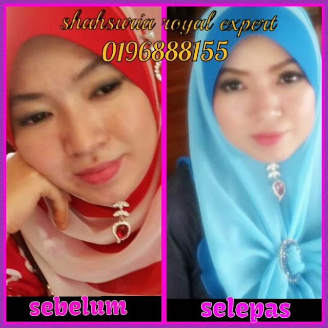 Promosi Royal Expert White Malaysia Original Royal Expert White Testimoni 9