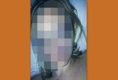 Δύσκολες ώρες για γνωστή ηθοποιό! Διεγνώσθη με καρκίνο στο δέρμα! Δείτε σοκαριστικές φωτογραφίες... Δύσκολες ώρες για γνωστή ηθοποιό! Διεγνώσθη με καρκίνο στο δέρμα! Δείτε σοκαριστικές φωτογραφίες...